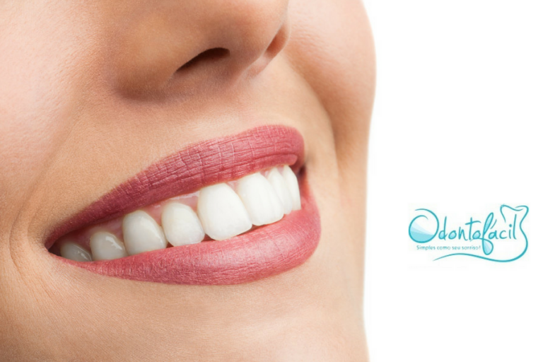 Odonto Fácil cliente da UNDER TI